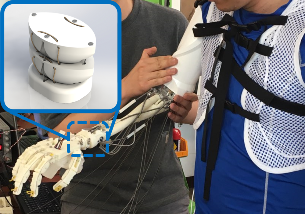 Bionic Arm