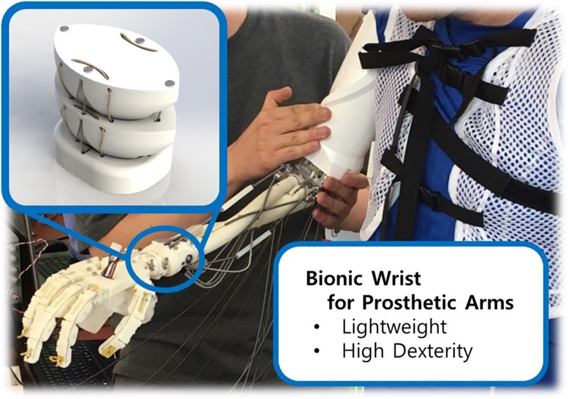 BionicArm